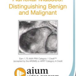 AIUM Adnexal Masses: Distinguishing Benign and Malignant | Medical Video Courses.