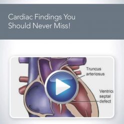 AIUM Cardiac Findings You Should Never Miss! | Medical Video Courses.