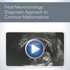 AIUM Fetal Neurosonology: Diagnostic Approach to Common Malformations | Medical Video Courses.