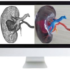 ARRS 3D Printing of Anatomic Models: Value Added Opportunity for Radiology 2019 | Medical Video Courses.
