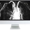 ARRS Advanced Chest Imaging 2019 | Medical Video Courses.