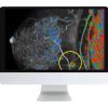 ARRS Breast Imaging Pearls and Pitfalls: Traditional and Novel Imaging Approaches 2020 | Medical Video Courses.
