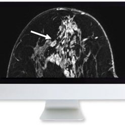 ARRS Clinical Case-Based Review of Breast Imaging 2019 | Medical Video Courses.