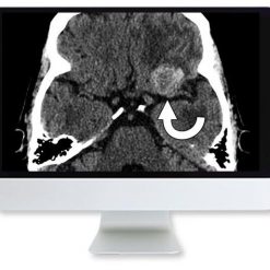ARRS Clinical Case-Based Review of Neuroradiology 2019 | Medical Video Courses.
