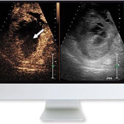 ARRS Clinical Case-Based Review of Ultrasound 2019 | Medical Video Courses.