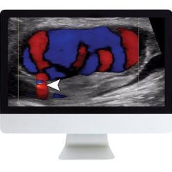 ARRS Clinical Ultrasound Review | Medical Video Courses.