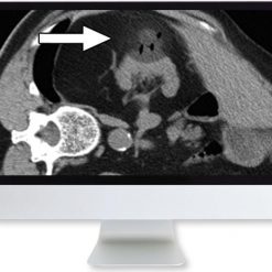 ARRS Cross-Sectional Renal Imaging: Techniques and Diagnosis 2020 | Medical Video Courses.