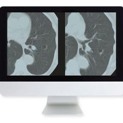 ARRS Lung Cancer Screening A Comprehensive Guide Online Course 2015 | Medical Video Courses.