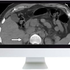 ARRS Male Genitourinary Imaging: From Anatomy to Oncology 2018 | Medical Video Courses.