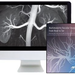 ARRS Multimodality Vascular Imaging: From Head to Toe 2020 | Medical Video Courses.
