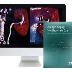 ARRS Oncologic Imaging From Diagnosis to Cure 2016 | Medical Video Courses.