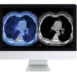 ARRS Practical PET/CT: What You Need to Know | Medical Video Courses.