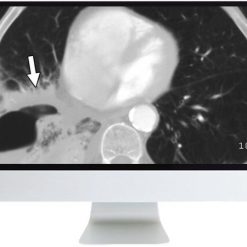 ARRS Radiology Review: Multispecialty Cases 2019 | Medical Video Courses.