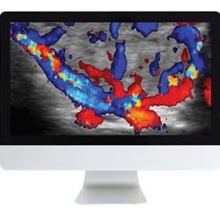 ARRS Thyroid Imaging | Medical Video Courses.