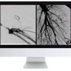 ARRS Vascular and Interventional Radiology Review 2016 | Medical Video Courses.