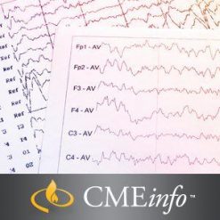 Cleveland Clinic Epilepsy Update & Review 2018 (Videos+PDFs) | Medical Video Courses.