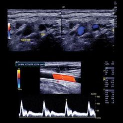 Clinical Approach to Vascular Ultrasound and RPVI Prep Course 2021 | Medical Video Courses.