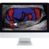 Clinical Ultrasound Review (ARRS) | Medical Video Courses.