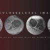 CME Science Musculoskeletal Imaging 2020 | Medical Video Courses.