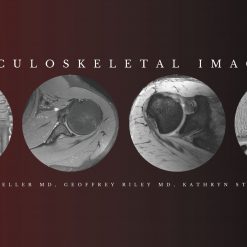 CME Science Musculoskeletal Imaging 2020 | Medical Video Courses.