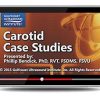 Gulfcoast Carotid Case Studies (Videos+PDFs) | Medical Video Courses.