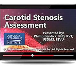 Gulfcoast Carotid Stenosis Assessment (Videos+PDFs) | Medical Video Courses.