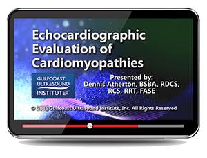 Gulfcoast Echocardiographic Evaluation of Cardiomyopathies (Videos+PDFs ...