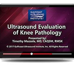 Gulfcoast Ultrasound Evaluation of Knee Pathology (Videos+PDFs) | Medical Video Courses.