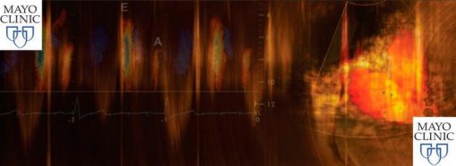 Mayo Clinic Echocardiography Online Board Review 2020 | Medical Video Courses.