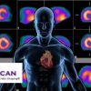Nuclear Cardiology Board Review 2018 | Medical Video Courses.